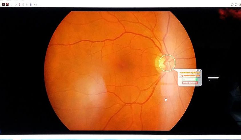 Oculistica
