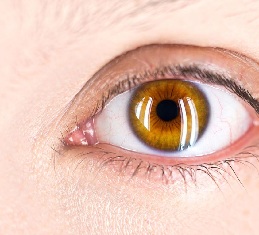 Protesi oculari